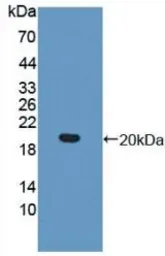 Human IL17 Receptor beta protein, His tag. GTX00144-pro