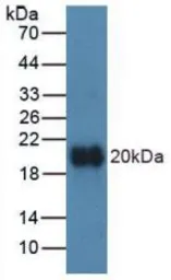 Human Vitamin D Receptor protein, His tag. GTX00163-pro
