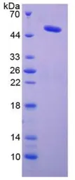 Human LOX protein, His and GST tag. GTX00167-pro
