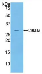 Human DNase I protein, His tag. GTX00172-pro