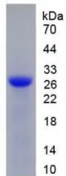 Human DNase I protein, His tag. GTX00172-pro