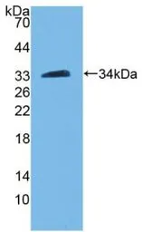 Human PAM protein, His tag. GTX00180-pro