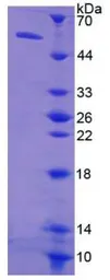 Human Thymidine Kinase 1 protein, His and GST tag. GTX00185-pro