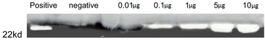 Human MMP13 protein, His tag (active). GTX00191-pro