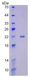 Human CYP3A4 protein, His tag. GTX00198-pro