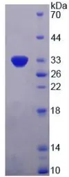 Human PDGF beta protein, His tag (active). GTX00204-pro