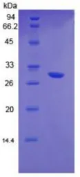 Human HGF protein, His tag (active). GTX00206-pro