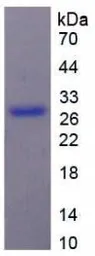 Human NG2 protein, His tag. GTX00208-pro