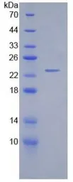 Human Gremlin 1 protein, His tag (active). GTX00209-pro