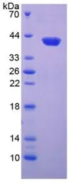 Human CXCL1 / GRO alpha protein, His and GST tag (active). GTX00215-pro