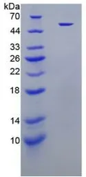Human Neutrophil elastase protein, His and GST tag. GTX00217-pro
