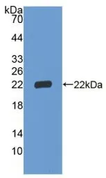Human IGFBP3 protein, His tag. GTX00231-pro