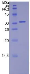 Human Syk protein, His tag. GTX00233-pro