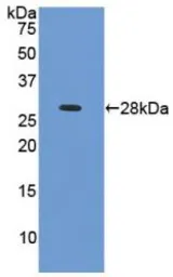 Human Cardiac Troponin I protein, His tag. GTX00237-pro