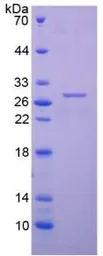 Human Cardiac Troponin I protein, His tag. GTX00237-pro