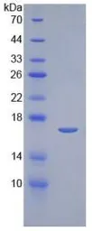 Human IL2 protein, His tag (active). GTX00265-pro
