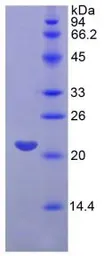Human FGF13 protein, His tag. GTX00266-pro