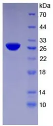 Human TFPI2 protein, His tag (active). GTX00278-pro