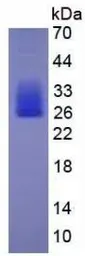 Mouse IL6 protein, His tag (active). GTX00286-pro