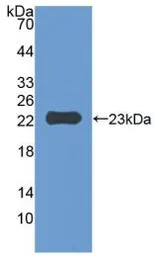 Mouse CD47 protein, His tag. GTX00311-pro