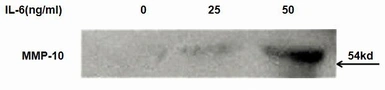 Rat IL6 protein, His tag (active). GTX00341-pro