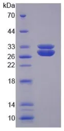 Human SOD3 protein, His tag. GTX00425-pro
