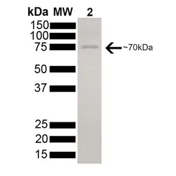 Human HSC70 protein, His tag (active). GTX00438-pro