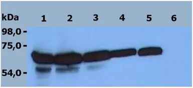 Anti-ZAP70 antibody [ZAP-03] used in Western Blot (WB). GTX00530