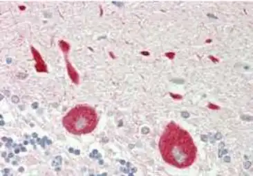 Anti-STYK1 antibody used in IHC (Paraffin sections) (IHC-P). GTX00635