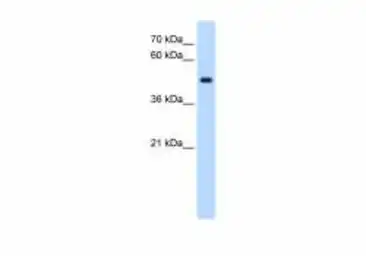 Anti-STYK1 antibody used in Western Blot (WB). GTX00635