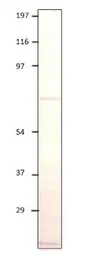 Anti-IL17 Receptor beta antibody used in Western Blot (WB). GTX00640