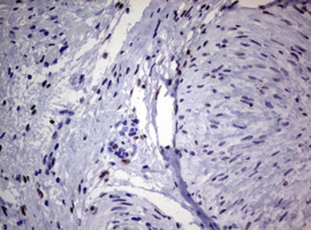 Anti-ZEB2 antibody [OTI1E12] used in IHC (Paraffin sections) (IHC-P). GTX00672