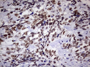 Anti-ZEB2 antibody [OTI1E12] used in IHC (Paraffin sections) (IHC-P). GTX00672