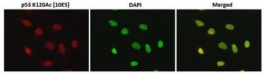Anti-p53 (Acetyl Lys120) antibody [10E5] used in Immunocytochemistry/ Immunofluorescence (ICC/IF). GTX00675