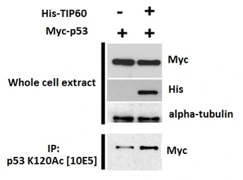 Anti-p53 (Acetyl Lys120) antibody [10E5] used in Immunoprecipitation (IP). GTX00675