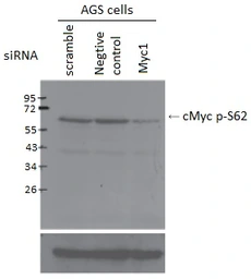 Anti-c-Myc (phospho Ser62) antibody [33A12E10] used in Western Blot (WB). GTX00684