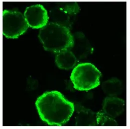 Anti-Herpes virus 6 gQ1 antibody [119] used in Immunocytochemistry/ Immunofluorescence (ICC/IF). GTX00685