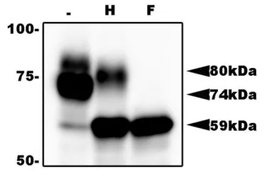 Anti-Herpes virus 6 gQ1 antibody [119] used in Western Blot (WB). GTX00685