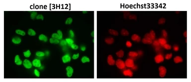 Anti-SUMO2 + SUMO3 antibody [3H12] used in Immunocytochemistry/ Immunofluorescence (ICC/IF). GTX00699