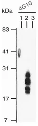 Anti-HB EGF antibody [4G10] used in Western Blot (WB). GTX00702