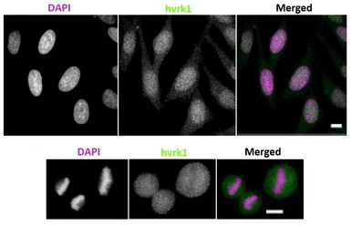 Anti-VRK1 antibody [5D1] used in Immunocytochemistry/ Immunofluorescence (ICC/IF). GTX00703