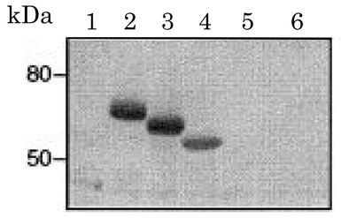 Anti-Fc epsilon R1 alpha antibody [CRA2] used in Western Blot (WB). GTX00712