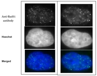 Anti-Rad51 antibody used in Immunocytochemistry/ Immunofluorescence (ICC/IF). GTX00720