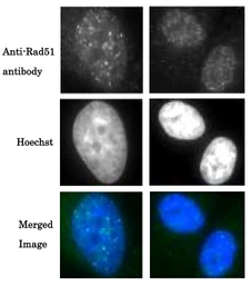 Anti-Rad51 antibody used in Immunocytochemistry/ Immunofluorescence (ICC/IF). GTX00721