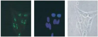 Anti-DDX18 antibody used in Immunocytochemistry/ Immunofluorescence (ICC/IF). GTX00725