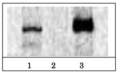 Anti-BRG1 antibody used in Immunoprecipitation (IP). GTX00727