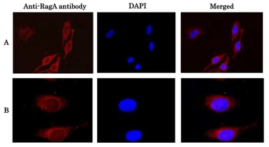 Anti-RRAGA antibody used in Immunocytochemistry/ Immunofluorescence (ICC/IF). GTX00730
