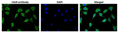 Anti-Calreticulin antibody used in Immunocytochemistry/ Immunofluorescence (ICC/IF). GTX00740