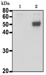 Anti-Calreticulin antibody used in Western Blot (WB). GTX00740