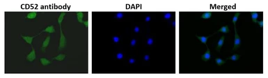 Anti-CD52 antibody used in Immunocytochemistry/ Immunofluorescence (ICC/IF). GTX00743